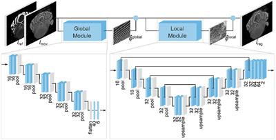 Supervised Learning With Perceptual Similarity for Multimodal Gene Expression Registration of a Mouse Brain Atlas